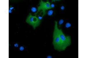 Immunofluorescence (IF) image for anti-Myotubularin Related Protein 14 (MTMR14) antibody (ABIN1499587) (MTMR14 antibody)