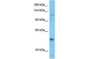 Host:  Mouse  Target Name:  HDAC6  Sample Tissue:  Mouse Spleen  Antibody Dilution:  1ug/ml (HDAC6 antibody  (C-Term))