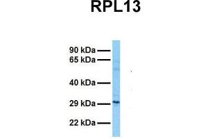 Host:  Rabbit  Target Name:  RPL13  Sample Tissue:  Human Fetal Lung  Antibody Dilution:  1. (RPL13 antibody  (C-Term))