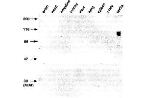 Western Blotting (WB) image for anti-Gena antibody (ABIN3201020)