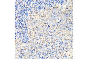 Immunohistochemistry (IHC) image for anti-FK506 Binding Protein 1A, 12kDa (FKBP1A) (AA 1-108) antibody (ABIN3022504)