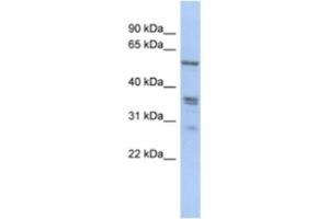 Western Blotting (WB) image for anti-Solute Carrier Family 38, Member 2 (SLC38A2) antibody (ABIN2463893) (SLC38A2 antibody)