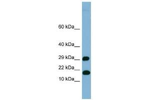 TRAPPC2L antibody used at 1 ug/ml to detect target protein. (TRAPPC2L antibody  (N-Term))