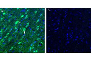 Free-floating frozen brain sections from a paraformaldehyde-perfused mouse were incubated with Anti-Neurokinin 2 Receptor (NK2R) Antibody (ABIN7043806, 1:200), followed by goat anti-rabbit secondary antibody conjugated to Alexa Fluor® 488 (green).