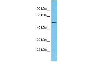 Western Blotting (WB) image for anti-Tetratricopeptide Repeat Domain 39C (TTC39C) (Middle Region) antibody (ABIN2791970) (TTC39C antibody  (Middle Region))
