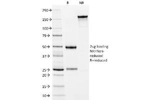SDS-PAGE Analysis Purified Cytokeratin 10 Mouse Monoclonal Antibody (LH2). (Keratin 10 antibody)