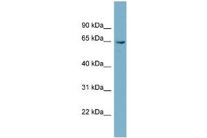 WB Suggested Anti-PGM3  Antibody Titration: 0. (Phosphoglucomutase 3 antibody  (N-Term))