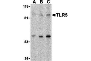 Western Blotting (WB) image for anti-Toll-Like Receptor 5 (TLR5) (C-Term) antibody (ABIN1030745)