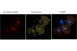 293 HEK cells transduced with Ad mCherry Rab1a and stained with anti-mCherry (mCherry antibody)