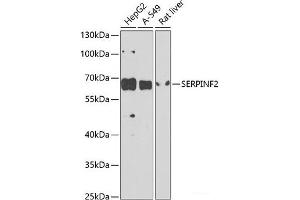 Western blot analysis of extracts of various cell lines using SERPINF2 Polyclonal Antibody at dilution of 1:1000. (alpha 2 Antiplasmin antibody)