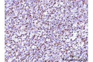 IHC analysis of RFX1 using anti-RFX1 antibody (ABIN7601842).