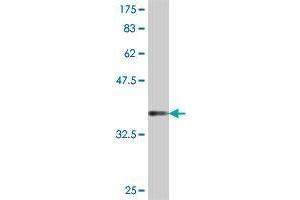 Western Blot detection against Immunogen (37 KDa) . (FGGY antibody  (AA 1-99))