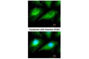 ICC/IF Image Immunofluorescence analysis of methanol-fixed HeLa, using OTUB1, antibody at 1:50 dilution. (OTUB1 antibody  (Center))