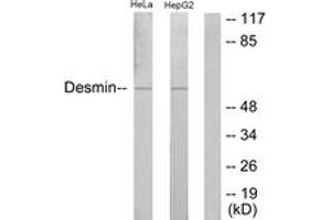 Western Blotting (WB) image for anti-Desmin (DES) (AA 26-75) antibody (ABIN2888927) (Desmin antibody  (AA 26-75))