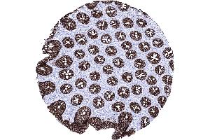 Rectum mucosa A strong membranous CDH17 staining occurs in all epithelial cells of the rectum mucosa CDH17 immunohistochemistry