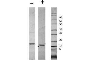 SDS-PAGE of Human CD40 Ligand Recombinant Protein SDS-PAGE of Human CD40 Ligand Recombinant Protein. (CD40 Ligand Protein (CD40LG))