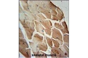 ACOT11 Antibody (C-term) (ABIN654089 and ABIN2843976) immunohistochemistry analysis in formalin fixed and paraffin embedded human skeletal muscle followed by peroxidase conjugation of the secondary antibody and DAB staining. (ACOT11 antibody  (C-Term))