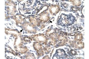 RGS20 antibody was used for immunohistochemistry at a concentration of 4-8 ug/ml to stain Epithelial cells of renal tubule (arrows) in Human Kidney. (RGS20 antibody  (Middle Region))
