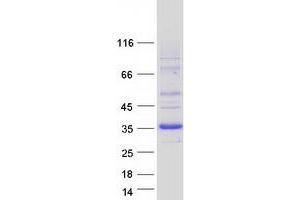 Validation with Western Blot (DHRS9 Protein (Transcript Variant 3) (Myc-DYKDDDDK Tag))