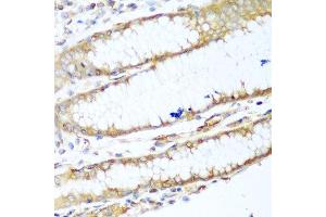 Immunohistochemistry of paraffin-embedded human stomach using MYH9 antibody at dilution of 1:100 (40x lens).