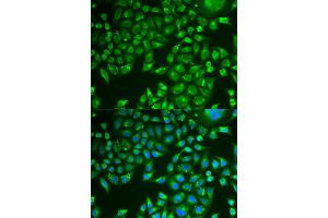 Immunofluorescence analysis of U2OS cell using PNLIP antibody. (PNLIP antibody)