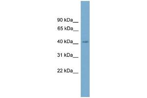 WB Suggested Anti-CXorf9 Antibody Titration: 0. (SASH3 antibody  (C-Term))