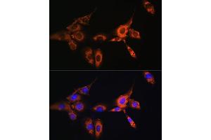 Immunohistochemistry (IHC) image for anti-Arrestin, beta 2 (ARRB2) (AA 300-400) antibody (ABIN3021620)