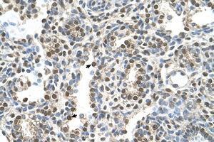 Image no. 1 for anti-Melanoma Antigen Family A, 8 (MAGEA8) (AA 51-100) antibody (ABIN6736631) (MAGEA8 antibody  (AA 51-100))