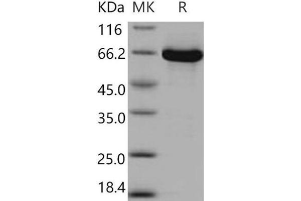 MEK1 Protein (GST tag,His tag)