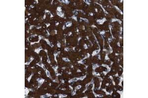 Immunohistochemical staining of human liver with CYP2C19 polyclonal antibody  shows strong cytoplasmic positivity in hepatocytes.