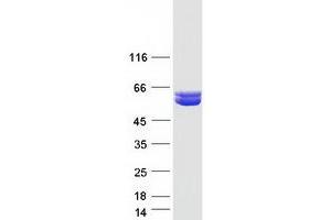 Validation with Western Blot (ALDH9A1 Protein (Myc-DYKDDDDK Tag))
