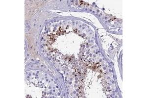 Immunohistochemical staining of human testis with SPACA4 polyclonal antibody  shows strong cytoplasmic positivity in spermatids. (SPACA4 antibody)