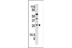 Western blot analysis of anti-AK3 Pab (ABIN392737 and ABIN2842197) in mouse kidney tissue lysate (35 μg/lane). (Adenylate Kinase 3 antibody  (N-Term))