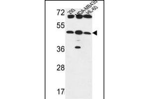 B3GNT5 Antibody (Center) (ABIN653601 and ABIN2842966) western blot analysis in 293,MDA-M,HL-60 cell line lysates (35 μg/lane). (B3GNT5 antibody  (AA 118-145))