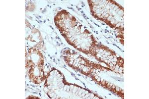 Immunohistochemistry of paraffin-embedded human stomach using CXCL12 antibody (ABIN6130152, ABIN6139271, ABIN6139272 and ABIN6217180) at dilution of 1:100 (40x lens). (CXCL12 antibody  (AA 22-89))