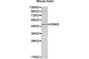 Western Blotting (WB) image for anti-GNAS Complex Locus (GNAS) antibody (ABIN1872845) (GNAS antibody)