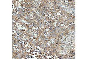 IHC analysis of ICAM1 using anti-ICAM1 antibody (ABIN5692991).