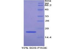 SDS-PAGE analysis of Mouse GPX4 Protein. (GPX4 Protein)