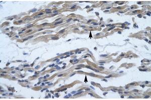 Immunohistochemistry (IHC) image for anti-Nuclear Factor of kappa Light Polypeptide Gene Enhancer in B-Cells 2 (NFKB2) (C-Term) antibody (ABIN2779436)