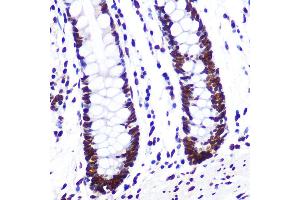Immunohistochemistry of paraffin-embedded human colon using KHDRBS1/KHDRBS1/Sam68 Rabbit mAb (ABIN1680037, ABIN3018237, ABIN3018238 and ABIN7101585) at dilution of 1:100 (40x lens). (KHDRBS1 antibody)