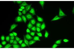 Immunofluorescence analysis of U2OS cells using RNF40 Polyclonal Antibody (RNF40 antibody)