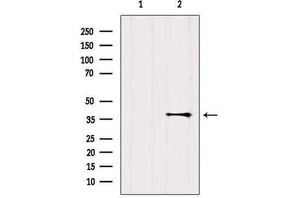 G Protein-Coupled Receptor 119 antibody  (Internal Region)