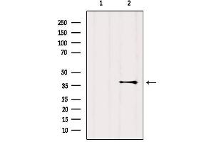Western blot analysis of extracts from Mouse brain, using GPR119 Antibody.