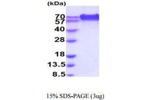 SDS-PAGE (SDS) image for CD320 Molecule (CD320) (AA 31-229) protein (hIgG-His-tag) (ABIN6388037) (CD320 Protein (AA 31-229) (hIgG-His-tag))