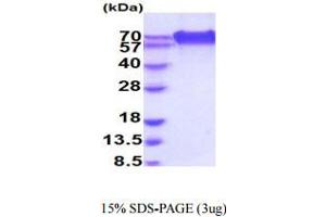 SDS-PAGE (SDS) image for CD320 Molecule (CD320) (AA 31-229) protein (hIgG-His-tag) (ABIN5778334)