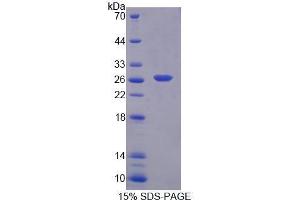 Image no. 1 for BCL2-Associated Athanogene (BAG1) (AA 174-355) protein (His tag) (ABIN5665263)