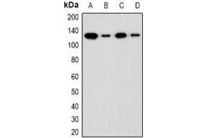 Western blot analysis of ADNP expression in LOVO (A), HCT116 (B), mouse liver (C), rat liver (D) whole cell lysates. (ADNP antibody  (N-Term))