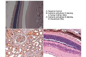 Immunohistochemistry with anti-carbonic anhydrase II antibody showing carbonic anhydrase II staining in nucleus and cytoplasm of proximal and distal tubules, bowman’s capsule and glomerular podocytes of human kidney (B) and in basal cells of retina of a mouse eye (C). (CA2 antibody)