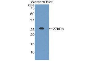 Western Blotting (WB) image for anti-Leukocyte Immunoglobulin-Like Receptor B3 (LILRB3) (AA 410-631) antibody (ABIN1859665) (LILRB3 antibody  (AA 410-631))
