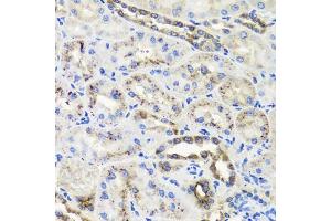 Immunohistochemistry of paraffin-embedded rat kidney using HSD11B2 antibody (ABIN5995471) at dilution of 1/100 (40x lens). (HSD11B2 antibody)